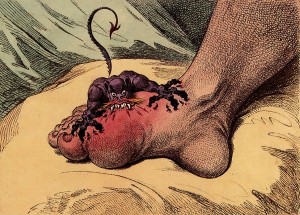 1799 gout illustration by James Gillray, public domain, Wikimedia